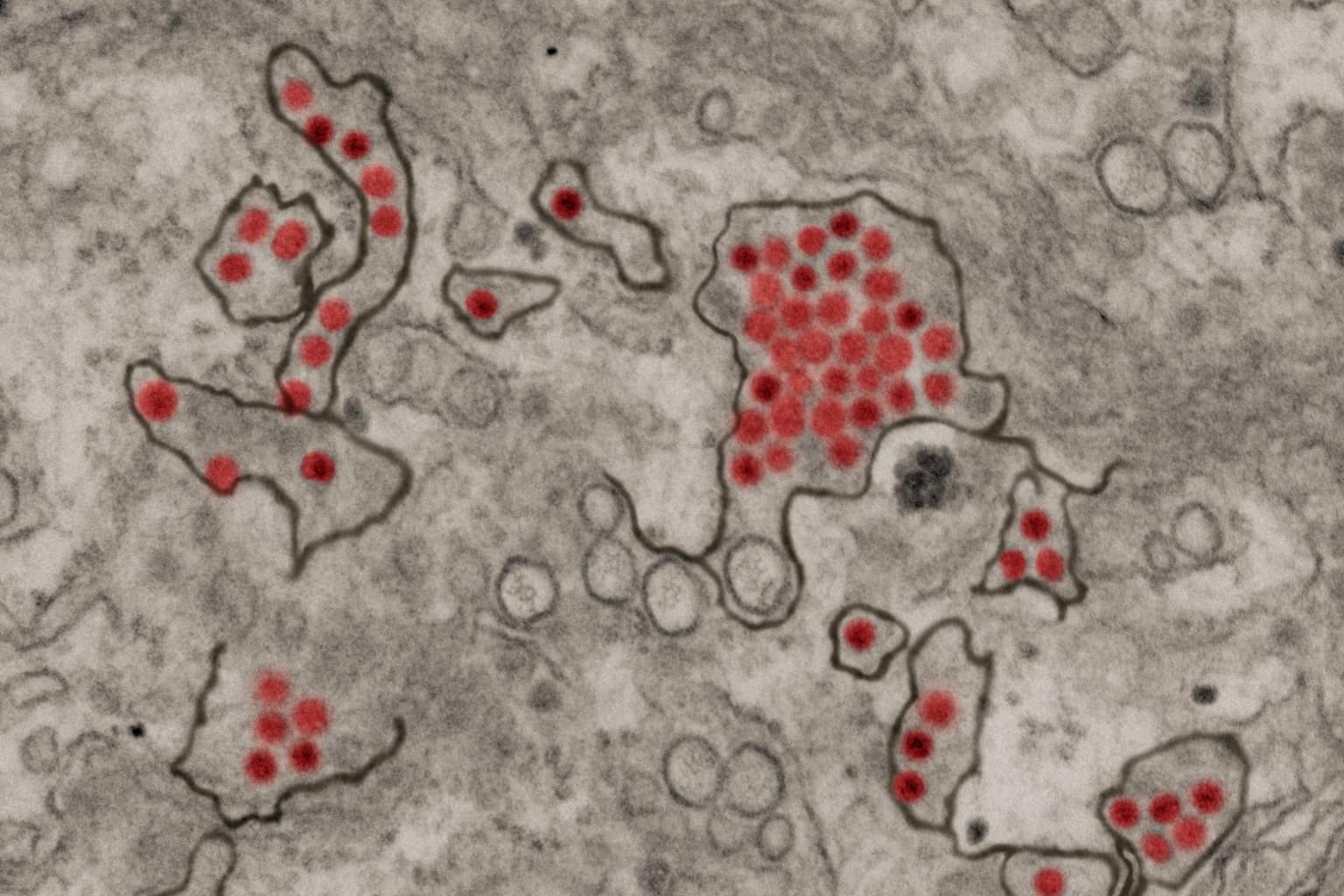 Photo: Zika Virus Particles (23686785478)