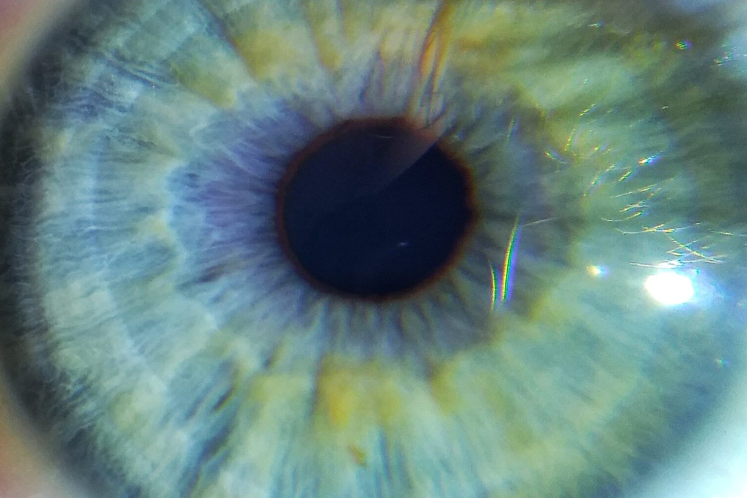 Symbolbild: Human eye detail, from- Human eye close up (cropped)