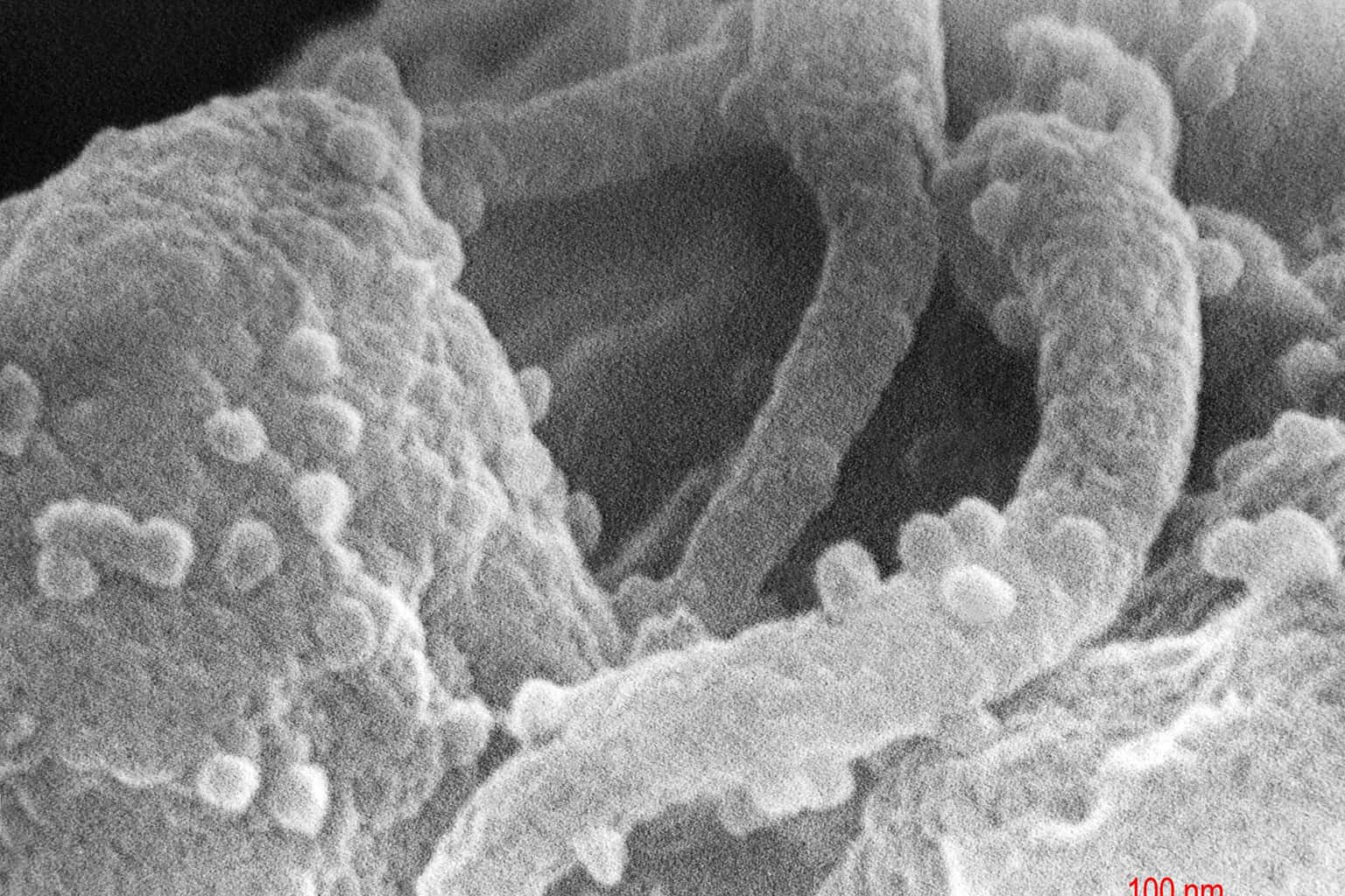 Illustrative photo: HIV-budding-BW-detail(2)