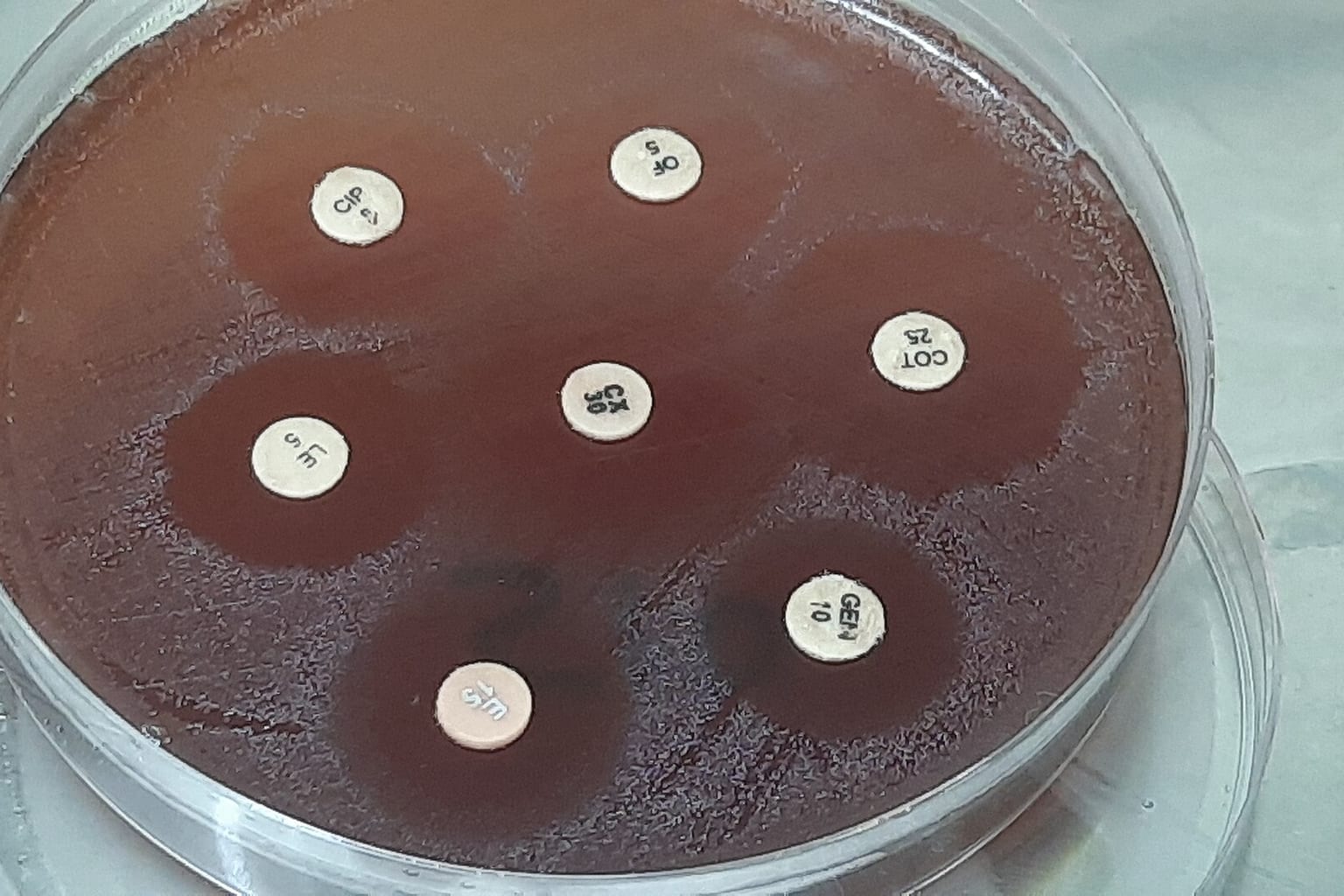 Photo d’illustration : Antibiogram result of Streptococcus agalactiae