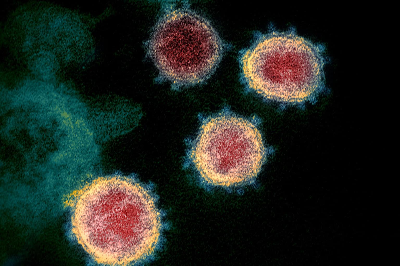Illustrative photo: Novel Coronavirus SARS-CoV-2