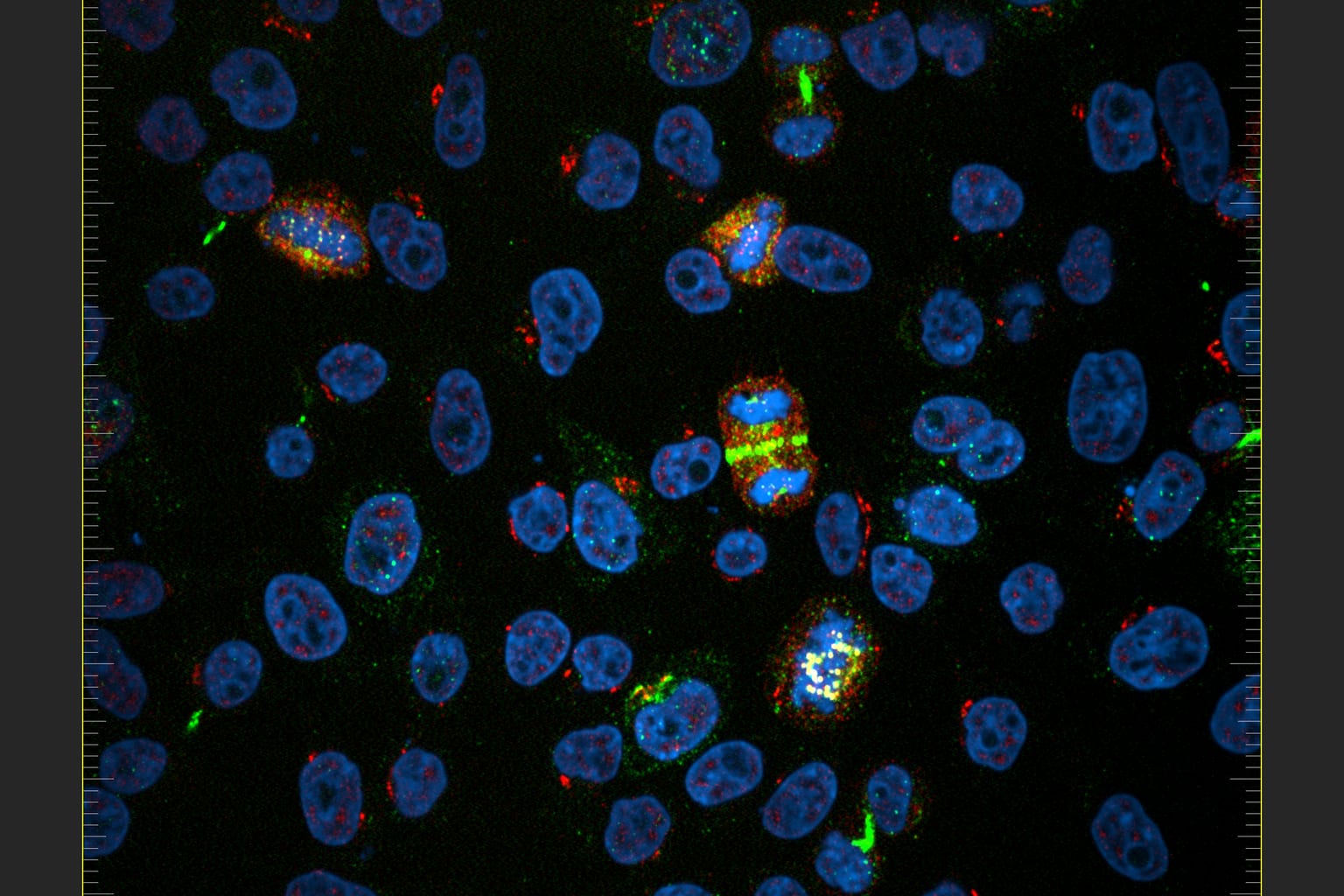 Photo d’illustration : A Cancer Cell at Its Most Ordered State
