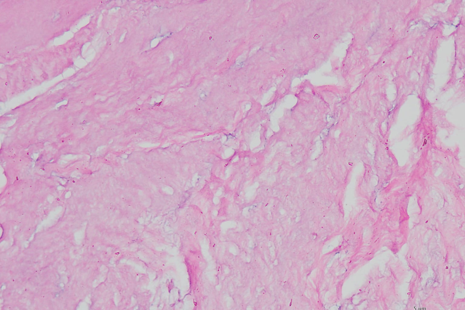 Illustrative photo: Decellularization of the Bovine Pericardium
